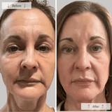 Omnilux Contour Face Mask