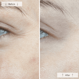 Omnilux Contour Face Mask