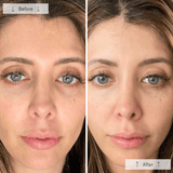 Omnilux Contour Face Mask