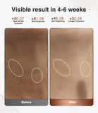 JOVS LED Red Light Therapy Mask