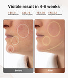 JOVS Red Light Face Mask
