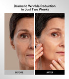 Red & Infrared LED Therapy for the Face