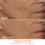 Dr Dennis Gross DRx SpectraLite DPL FaceWare Pro