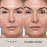 TheraFace PRO Multi-Tech. Facial Device (LED, Microcurrent & Massage)