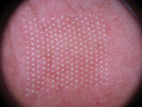 Image showing close up skin