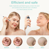 Image showing before and after comparison of a woman's face. Diamond Microdermabrasion machine is an ideal device purchase for skin rejuvenation and other treatments.