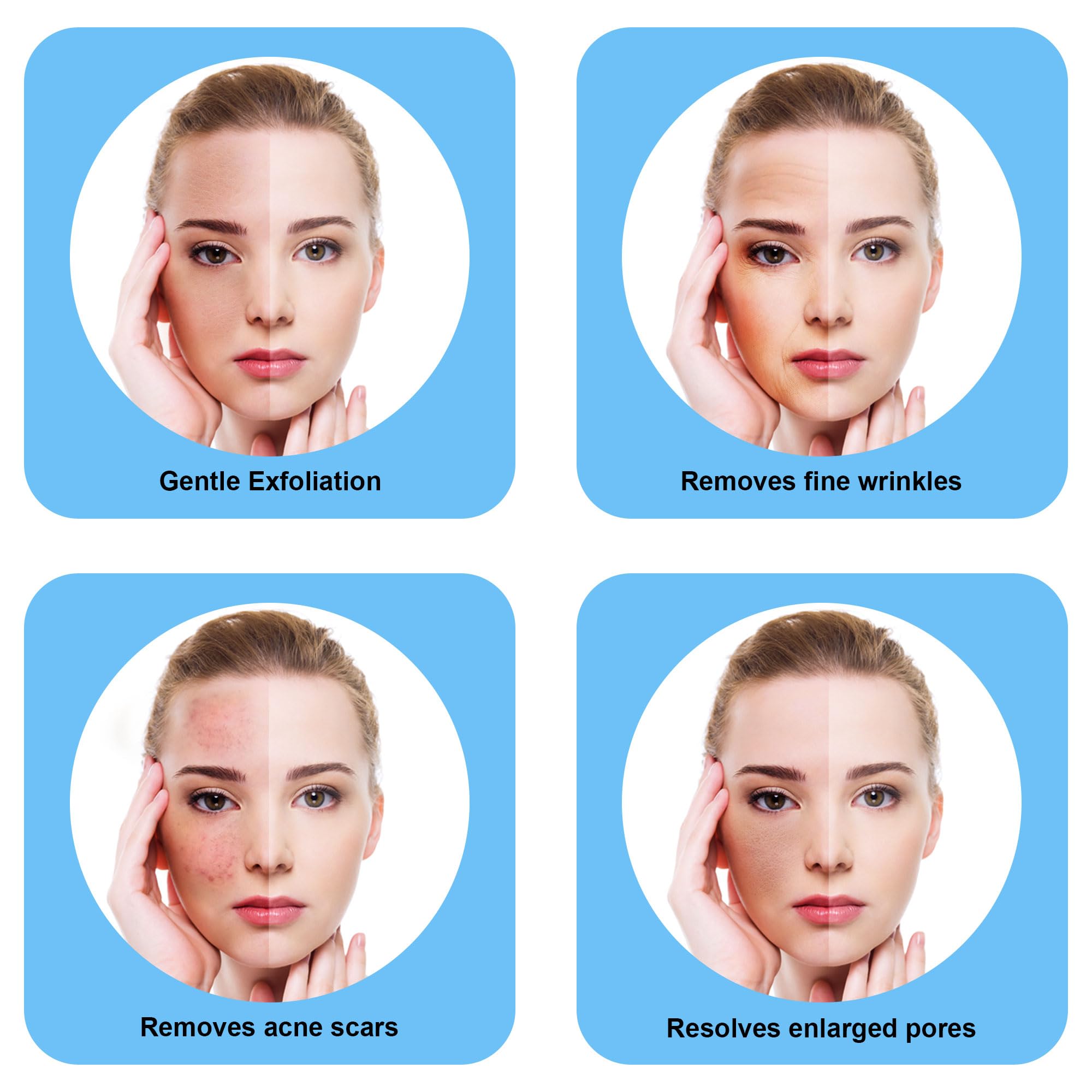 Image showing 4 benefits of Microdermabrasion devices. It is an ideal device purchase.
