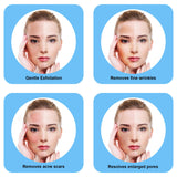 Image showing 4 benefits of Microdermabrasion devices. It is an ideal device purchase.