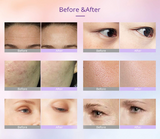Facial Rejuvenation Microcurrent Device with 7 LED Lights
