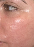 Versatile Fractional CO2 Laser System for Advanced Skin Rejuvenation & Private Health
