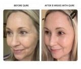 Q-Rejuvalight Pro Facewear