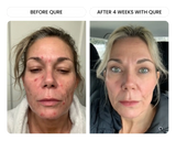 Q-Rejuvalight Pro Facewear