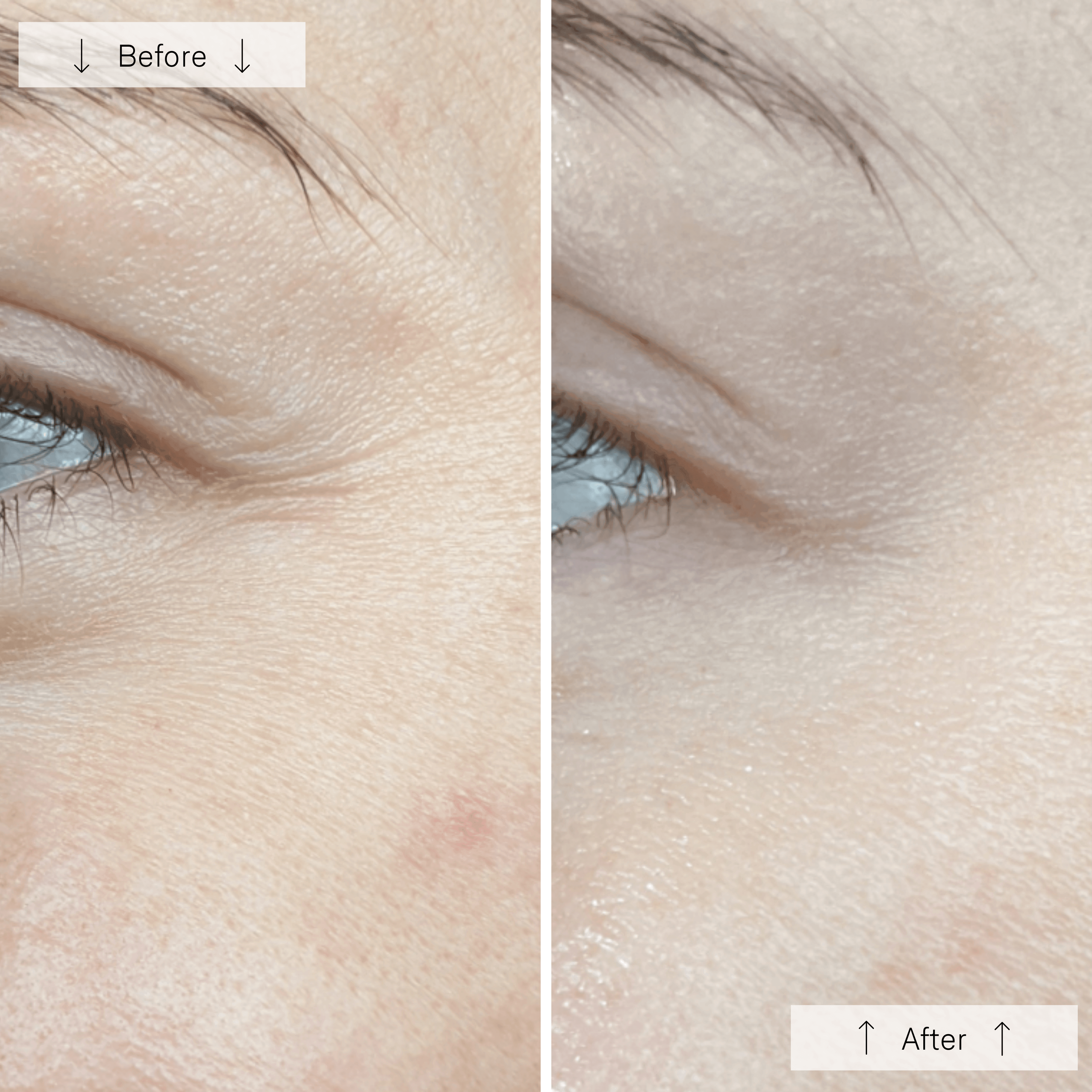 Omnilux Contour Face Mask