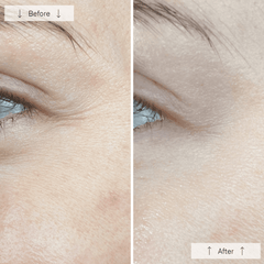 Omnilux Contour Face Mask