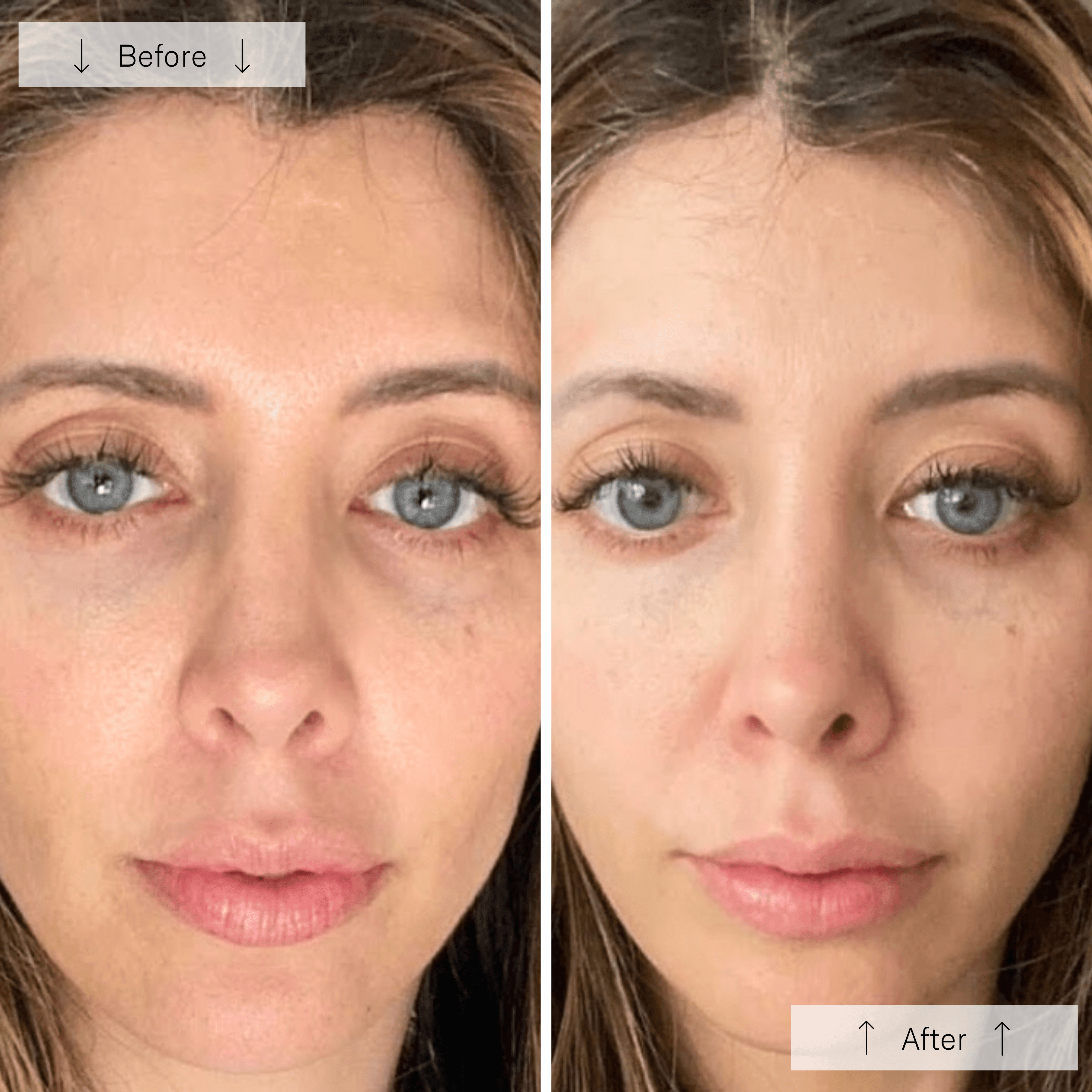 Omnilux Contour Face Mask