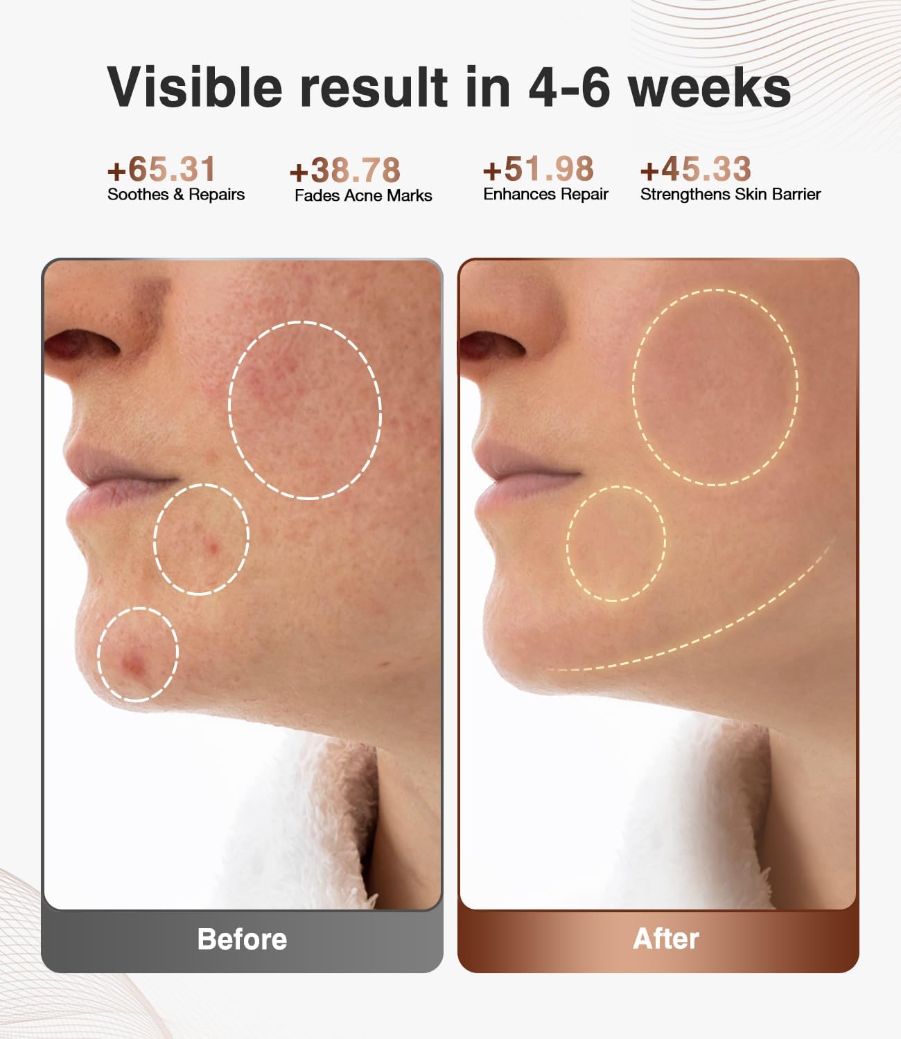 JOVS Red Light Face Mask