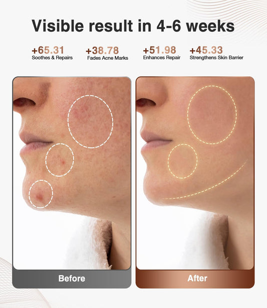JOVS Red Light Face Mask