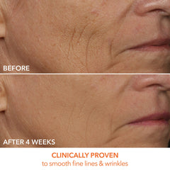 Dr Dennis Gross DRx SpectraLite DPL FaceWare Pro