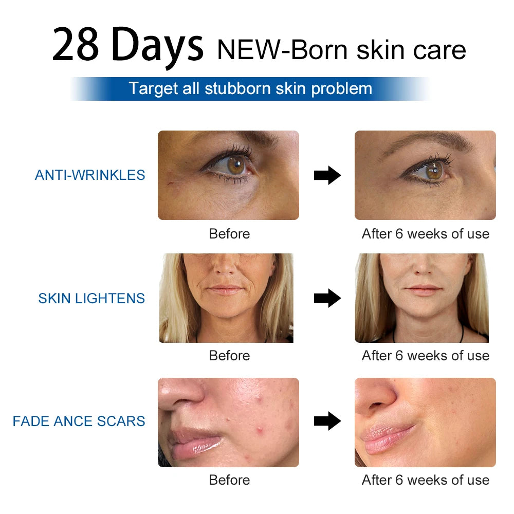 Image showing 28 days skincare regime and before and after sin problems and it's sloutions.