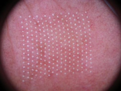 Image showing close up skin