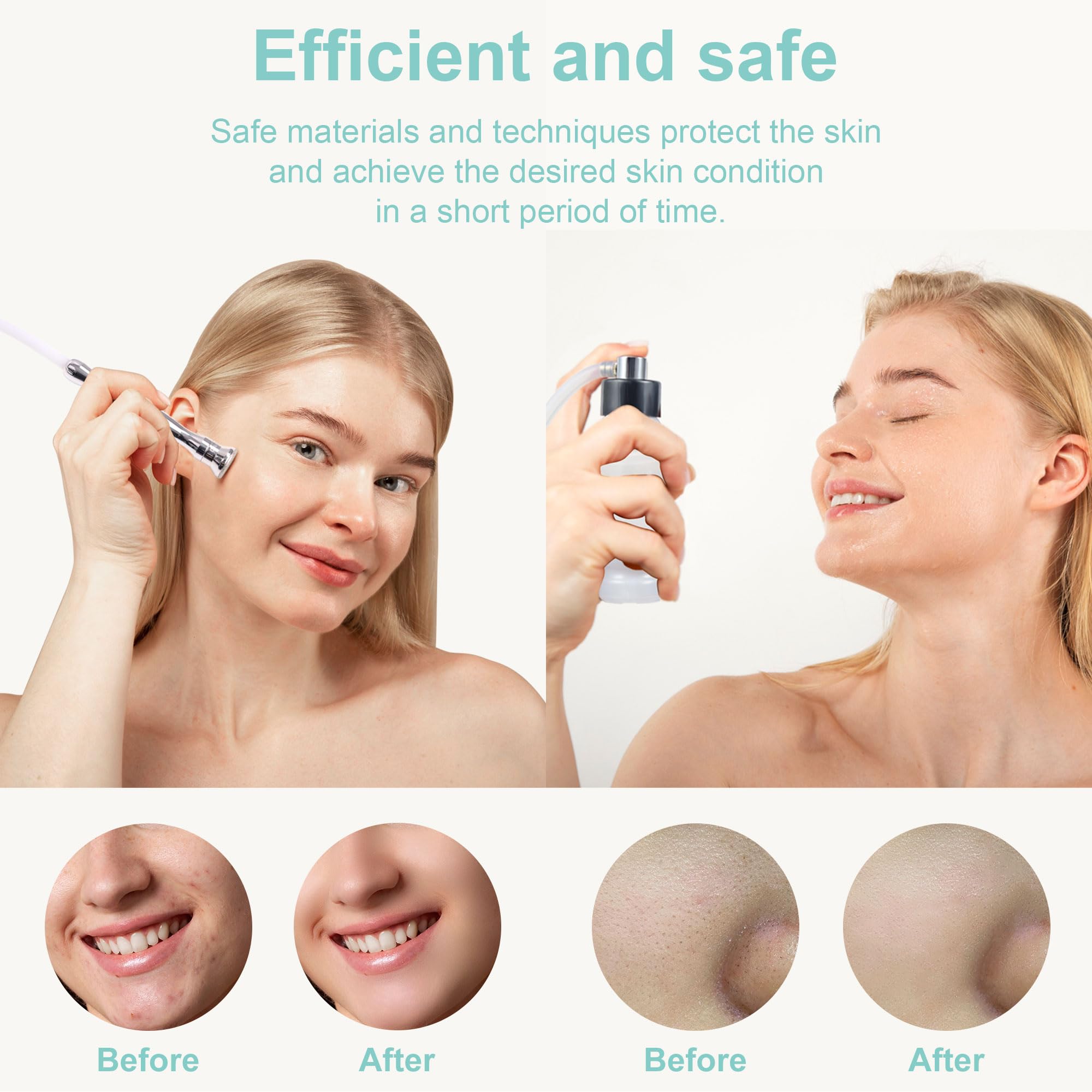 Image showing before and after comparison of a woman's face. Diamond Microdermabrasion machine is an ideal device purchase for skin rejuvenation and other treatments.