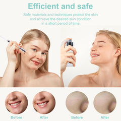 Image showing before and after comparison of a woman's face. Diamond Microdermabrasion machine is an ideal device purchase for skin rejuvenation and other treatments.