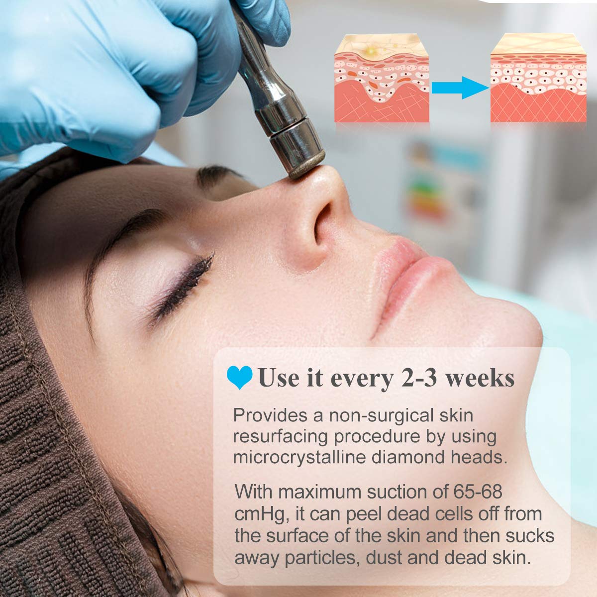 Professional diamond microdermabrasion machine in action  showing its' benefits. It is the best device purchase.