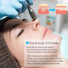Professional diamond microdermabrasion machine in action  showing its' benefits. It is the best device purchase.