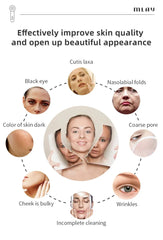 MLAY Handheld RF Beauty Device for Skin Rejuvenation