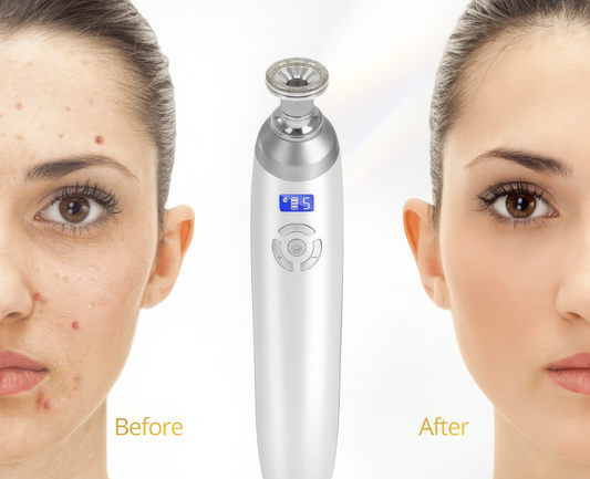 Before and after comparison of a skin treatment device on a woman's face.
