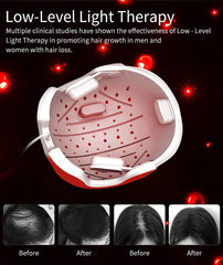 Advanced Hair Growth Helmet With Red Light Therapy