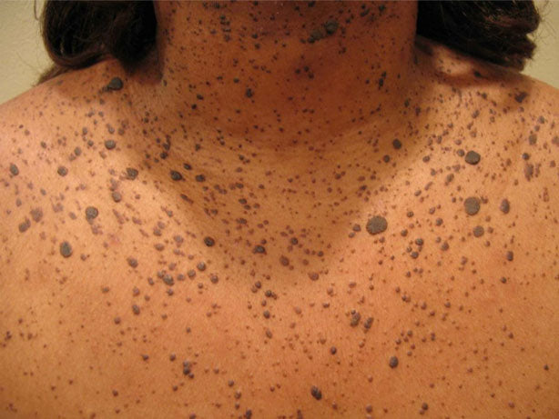 Image showing skin disease