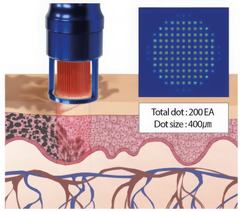 Microarray slide with a magnified view of a sample and technical details.