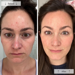 Omnilux Contour Face Mask