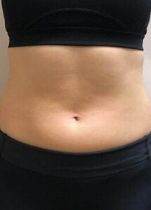 PZLASER UMS Sculptor: Advanced Electromagnetic Muscle Building & Fat Reduction System