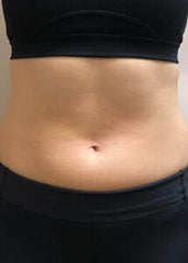 PZLASER UMS Sculptor: Advanced Electromagnetic Muscle Building & Fat Reduction System
