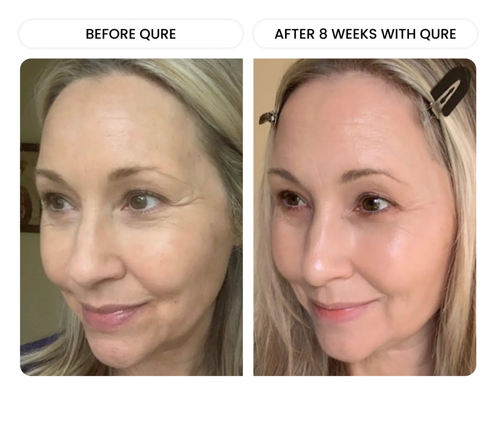 Q-Rejuvalight Pro Facewear