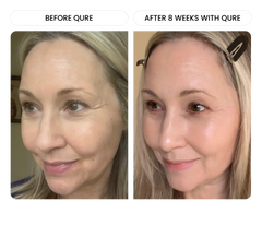 Q-Rejuvalight Pro Facewear