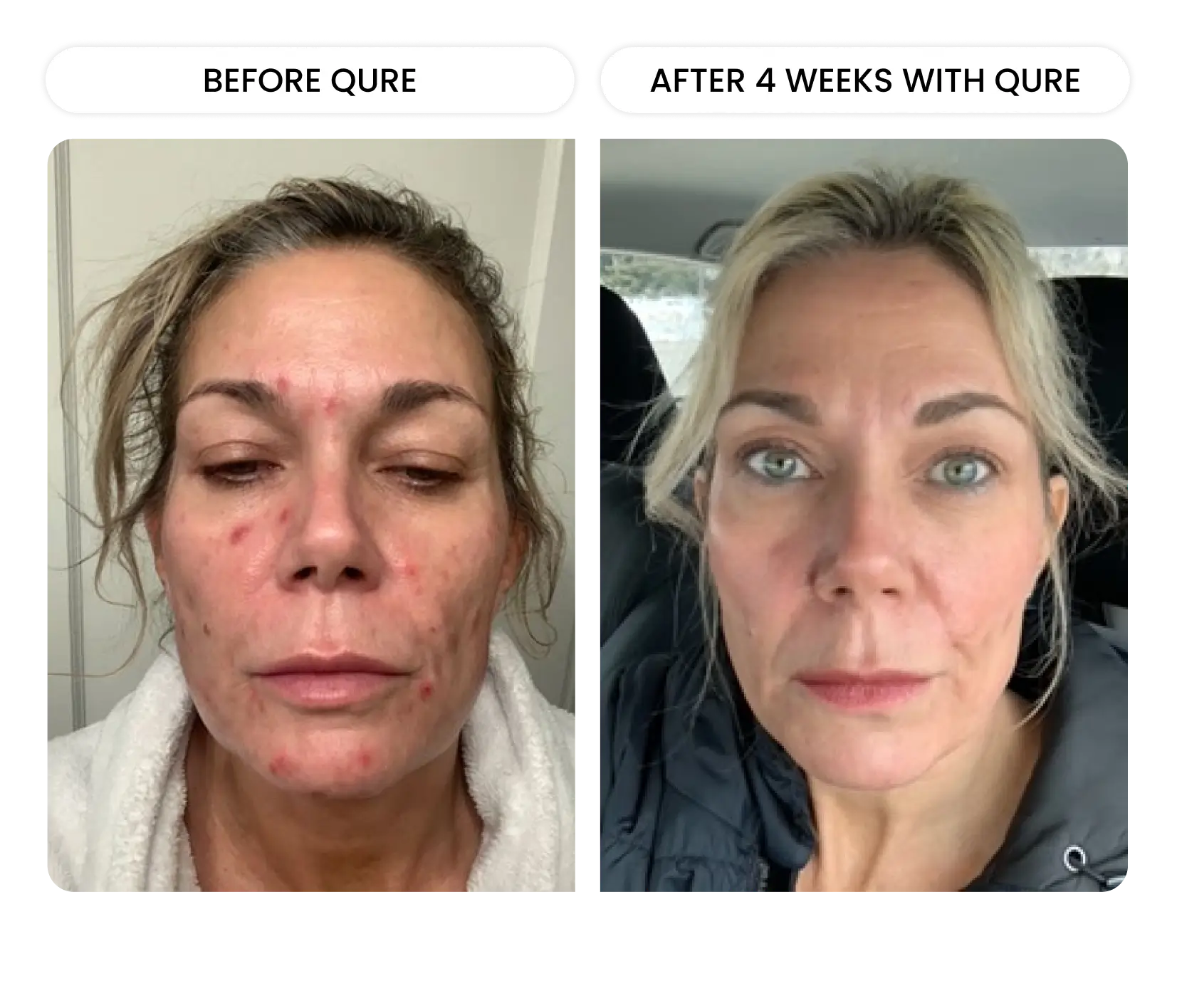 Q-Rejuvalight Pro Facewear