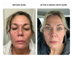 Q-Rejuvalight Pro Facewear